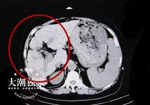 ccgg.ct吃瓜官网,带你领略网络吃瓜新潮流
